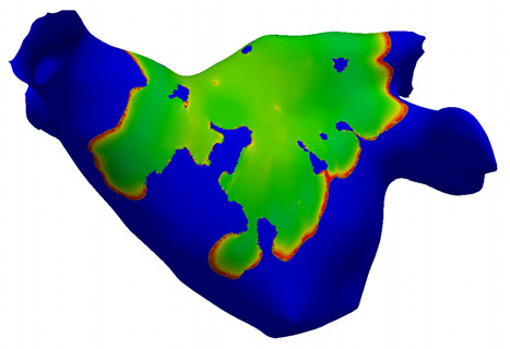 An illustrative simulation of a depolarising electrochemical wavefront on a two-dimensional manifold representing a human left atrium: blue is unexcited tissue, green is depolarised tissue, and red highlights the wavefront.